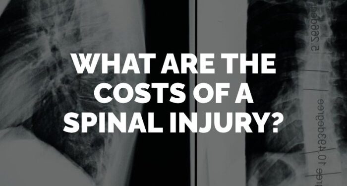 What Are the Lifetime Costs of a Spinal Cord Injury?